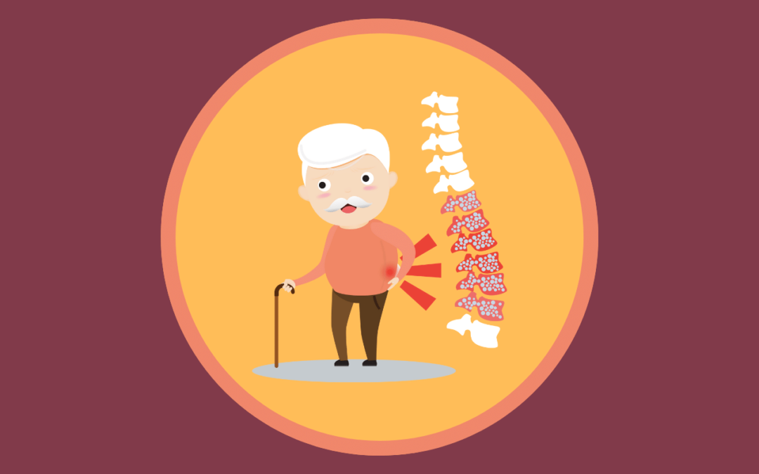 Living With Osteoporosis – Tips And Tricks