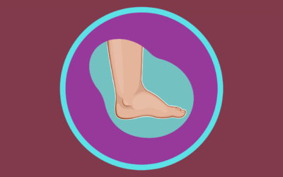 Ways to Help Your Swollen Feet & Ankles