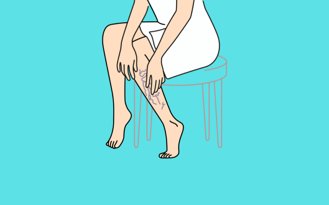 Understanding the Causes of Poor Leg Circulation