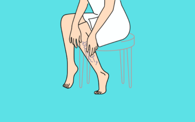 Understanding the Causes of Poor Leg Circulation