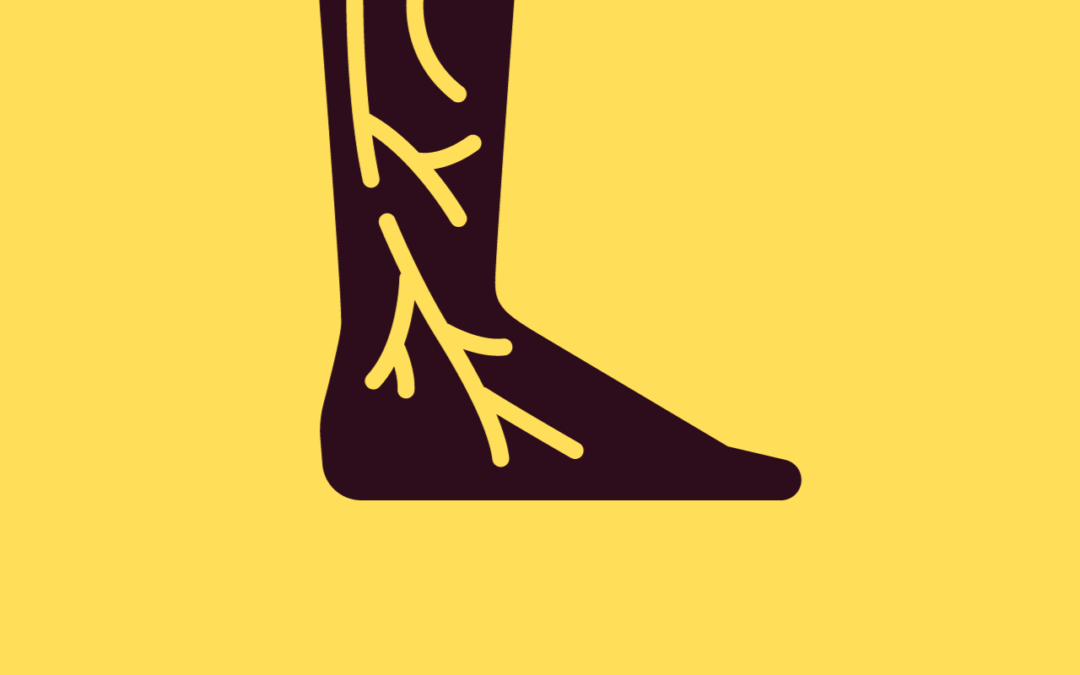 What are the signs of poor circulation in feet?