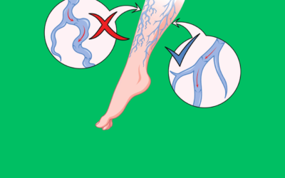 How do you fix poor circulation in your feet?