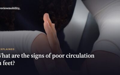 What are the signs of poor circulation in feet?